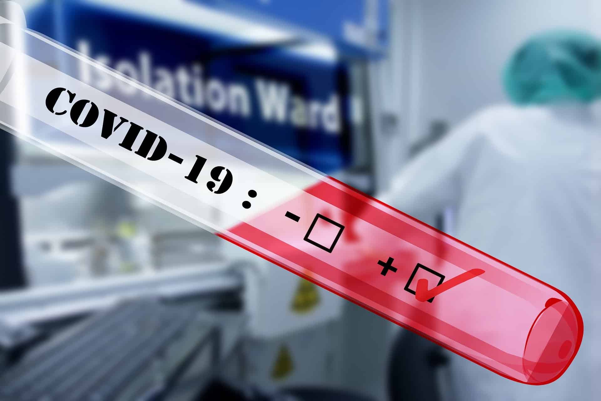 covid-19 virus testing